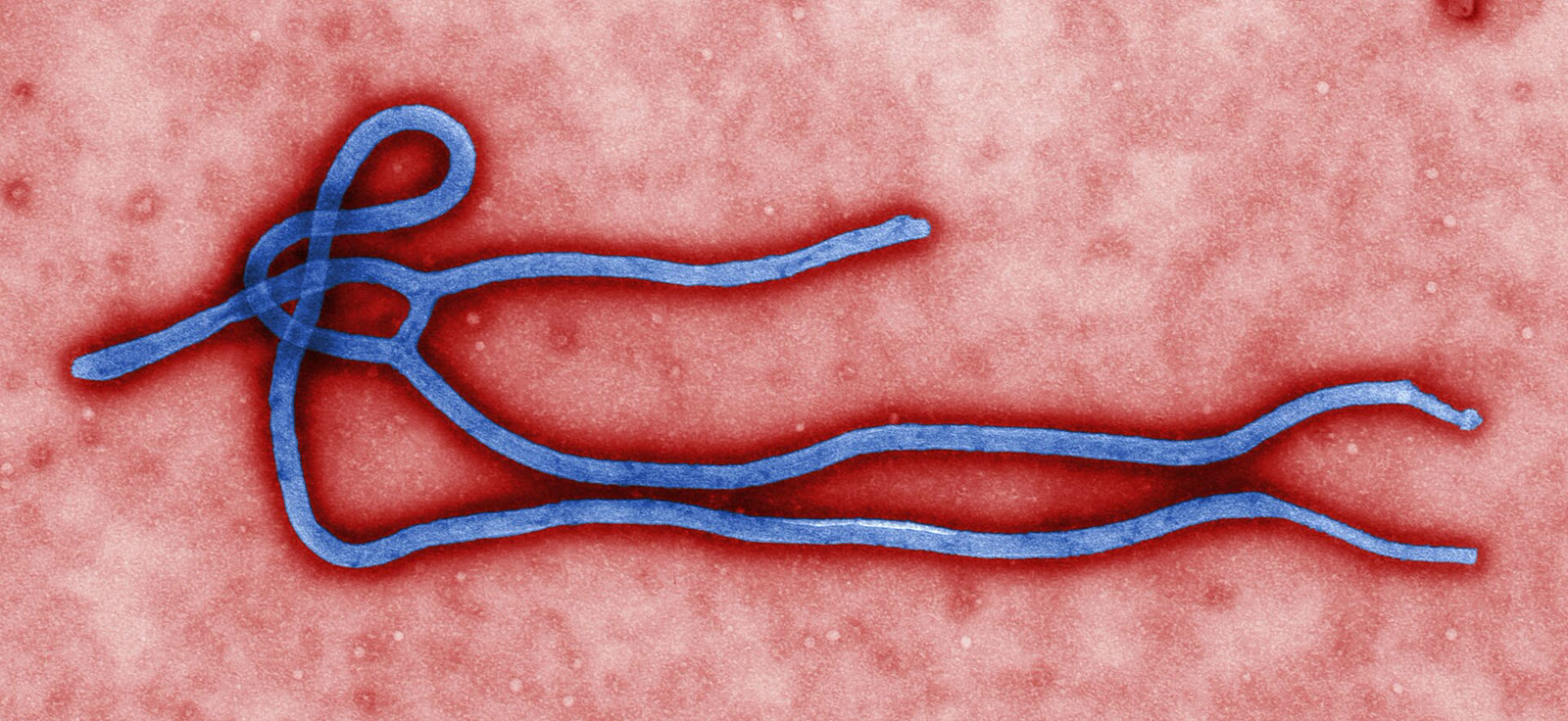 Mikroskop altında Ebola virüsü (arşiv)