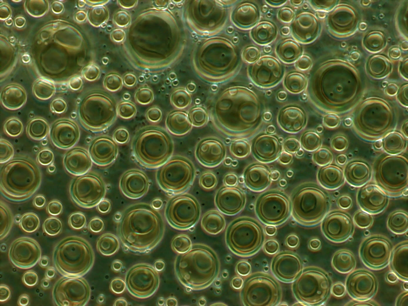 Liposomes under a microscope (archive)